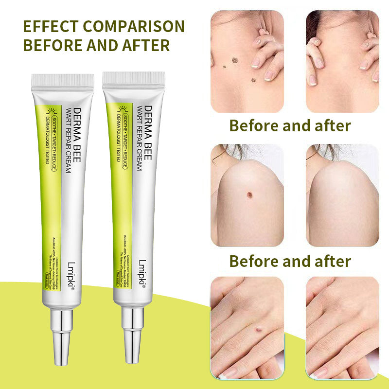 【 𝐿𝑚𝑖𝑝𝑘𝑖®Official Store✅】𝙇𝙢𝑖𝑝𝙠𝙞® Derma  Repair Cream (𝗔𝗽𝗽𝗹𝘆 𝘁𝘄𝗶𝗰𝗲 𝗱𝗮𝗶𝗹𝘆, 𝘄𝗮𝗿𝘁-𝗳𝗿𝗲𝗲 𝗿𝗲𝘀𝘂𝗹𝘁𝘀 𝗶𝗻 𝟮–𝟯 𝘄𝗲𝗲𝗸𝘀) ✅ 𝐅𝐨𝐫 𝒔𝒌𝒊𝒏 𝒕𝒂𝒈, 𝒘𝒓𝒊𝒏𝒌𝒍𝒆𝒔, 𝒗𝒊𝒕𝒊𝒍𝒊𝒈𝒐, 𝒓𝒐𝒔𝒂𝒄𝒆𝒔, 𝒆𝒄𝒛𝒎𝒂, 𝒖𝒓𝒕𝒊𝒄𝒂𝒓𝒊𝒂, 𝒅𝒓𝒚 𝒂𝒏𝒅 𝒇𝒍𝒂𝒌𝒚, 𝐚𝐧𝐝 𝐦𝐨𝐫𝐞