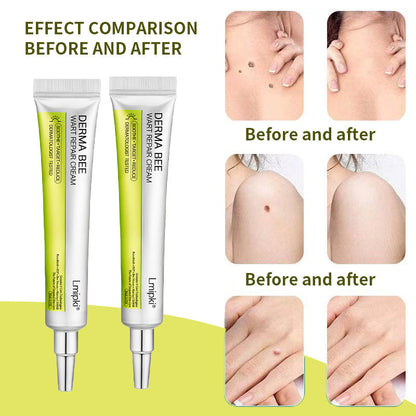 【 𝐿𝑚𝑖𝑝𝑘𝑖®Official Store✅】𝙇𝙢𝑖𝑝𝙠𝙞® Derma  Repair Cream (𝗔𝗽𝗽𝗹𝘆 𝘁𝘄𝗶𝗰𝗲 𝗱𝗮𝗶𝗹𝘆, 𝘄𝗮𝗿𝘁-𝗳𝗿𝗲𝗲 𝗿𝗲𝘀𝘂𝗹𝘁𝘀 𝗶𝗻 𝟮–𝟯 𝘄𝗲𝗲𝗸𝘀) ✅ 𝐅𝐨𝐫 𝒔𝒌𝒊𝒏 𝒕𝒂𝒈, 𝒘𝒓𝒊𝒏𝒌𝒍𝒆𝒔, 𝒗𝒊𝒕𝒊𝒍𝒊𝒈𝒐, 𝒓𝒐𝒔𝒂𝒄𝒆𝒔, 𝒆𝒄𝒛𝒎𝒂, 𝒖𝒓𝒕𝒊𝒄𝒂𝒓𝒊𝒂, 𝒅𝒓𝒚 𝒂𝒏𝒅 𝒇𝒍𝒂𝒌𝒚, 𝐚𝐧𝐝 𝐦𝐨𝐫𝐞