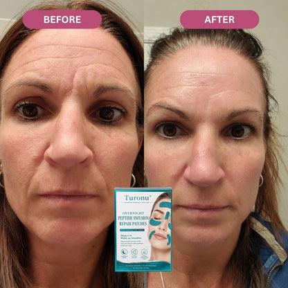 𝐎𝐟𝐟𝐢𝐜𝐢𝐚𝐥 𝐁𝐫𝐚𝐧𝐝 𝐒𝐭𝐨𝐫𝐞丨Turonu® Peptide-Infusion Face & Eye Repair Tape🌛-Visibly diminishes fine lines overnight.