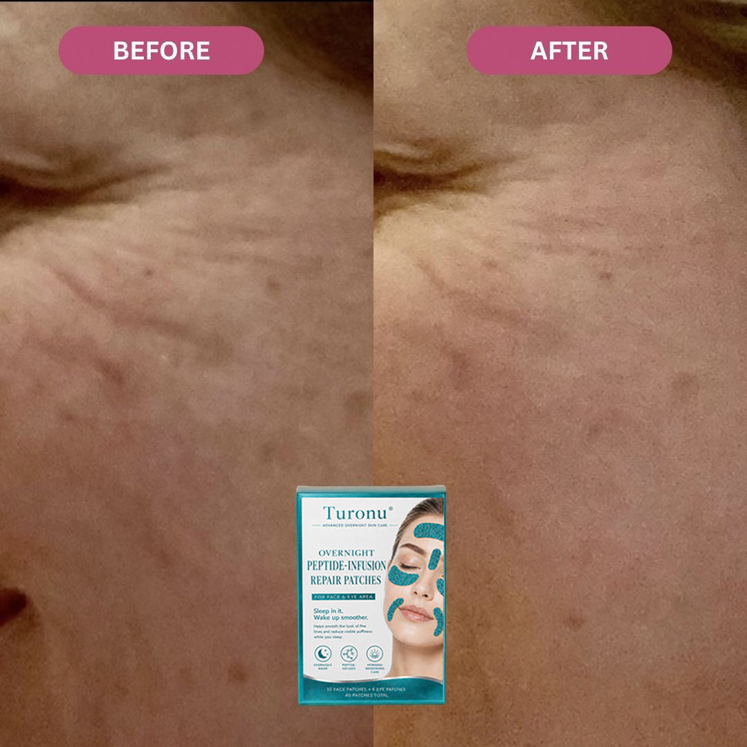 𝐎𝐟𝐟𝐢𝐜𝐢𝐚𝐥 𝐁𝐫𝐚𝐧𝐝 𝐒𝐭𝐨𝐫𝐞丨Turonu® Peptide-Infusion Face & Eye Repair Tape🌛-Visibly diminishes fine lines overnight.