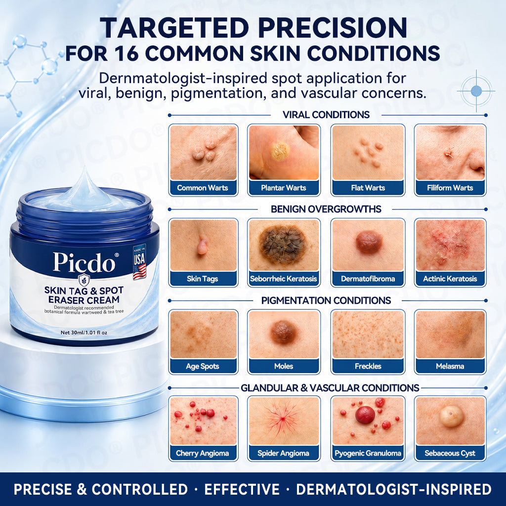 𝐏𝐡𝐚𝐫𝐦𝐚𝐜𝐢𝐬𝐭 𝐑𝐞𝐜𝐨𝐦𝐦𝐞𝐧𝐝𝐞𝐝🥇𝐏𝐢𝐜𝐝𝐨® 7-𝐃𝐚𝐲 𝐒𝐤𝐢𝐧 𝐓𝐚𝐠 & 𝐒𝐩𝐨𝐭 𝐄𝐫𝐚𝐬𝐞𝐫 𝐂𝐫𝐞𝐚𝐦 🍀(Zero Pain, Zero 𝐒𝐜𝐚𝐫𝐬 Formula)