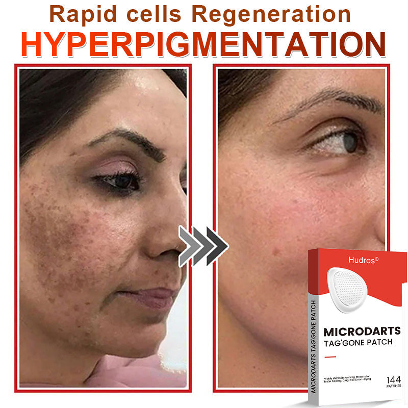 👩🏼‍⚕️ Hudros® 2-in-1 Microneedle & Hydrocolloid Patch | Raised Moles,Acne,  Flat Warts & Skin Tags Remover | Improves Wrinkles, Scars & Blemishes | Invisible Star Pimple Patches for Face & Body | 144 Count