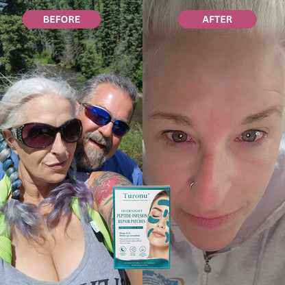 𝐎𝐟𝐟𝐢𝐜𝐢𝐚𝐥 𝐁𝐫𝐚𝐧𝐝 𝐒𝐭𝐨𝐫𝐞丨Turonu® Peptide-Infusion Face & Eye Repair Tape🌛-Visibly diminishes fine lines overnight.